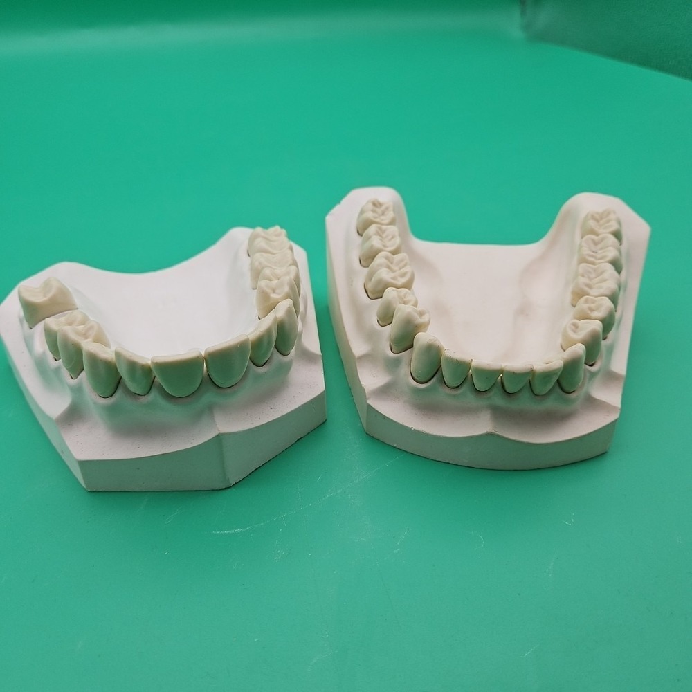Vintage Dentist Fake Jaws‎ With Removable Teeth Gums Top And Bottom Row Plaster